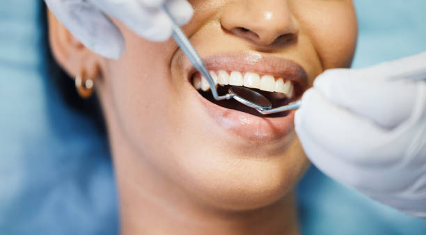 Best Emergency Tooth Extraction in Morehead City, NC
