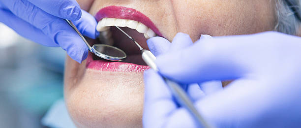 Best Emergency Tooth Extraction in Morehead City, NC
